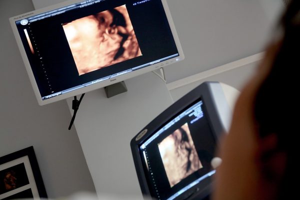 Control prenatal: feto, de desconocido a paciente en menos de 30 años