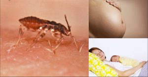 La enfermedad de Chagas