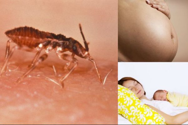 La enfermedad de Chagas