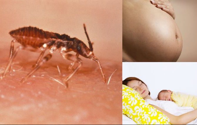 La enfermedad de Chagas