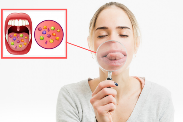 Diseases that are transmitted through kissing
