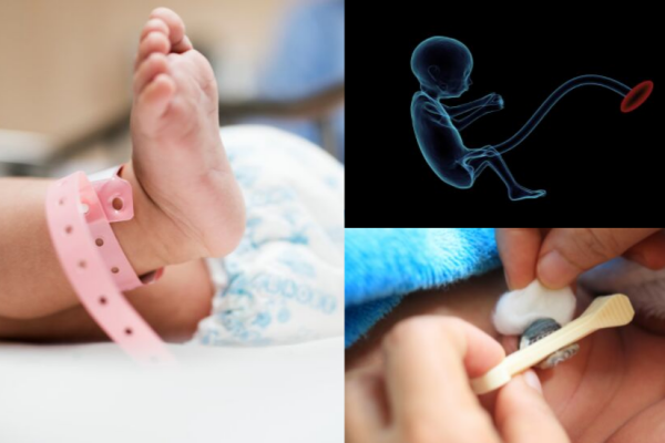 El cordón umbilical, el conducto de la vida (dudas comunes)