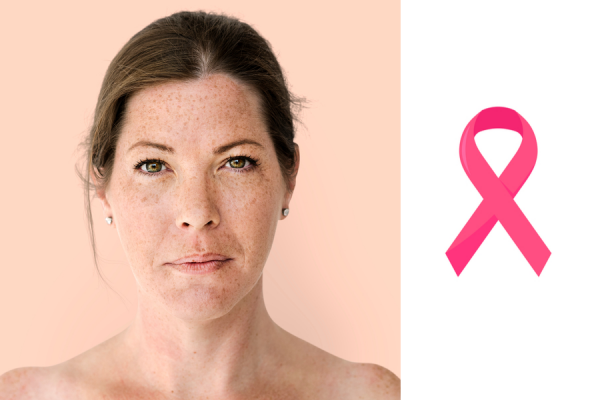 Tratamiento quirúrgico del cáncer de mama