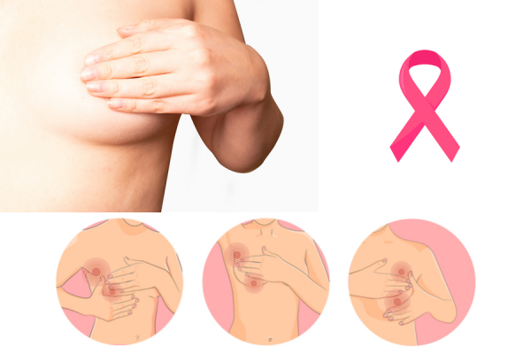 Tipos de Cáncer de Mama